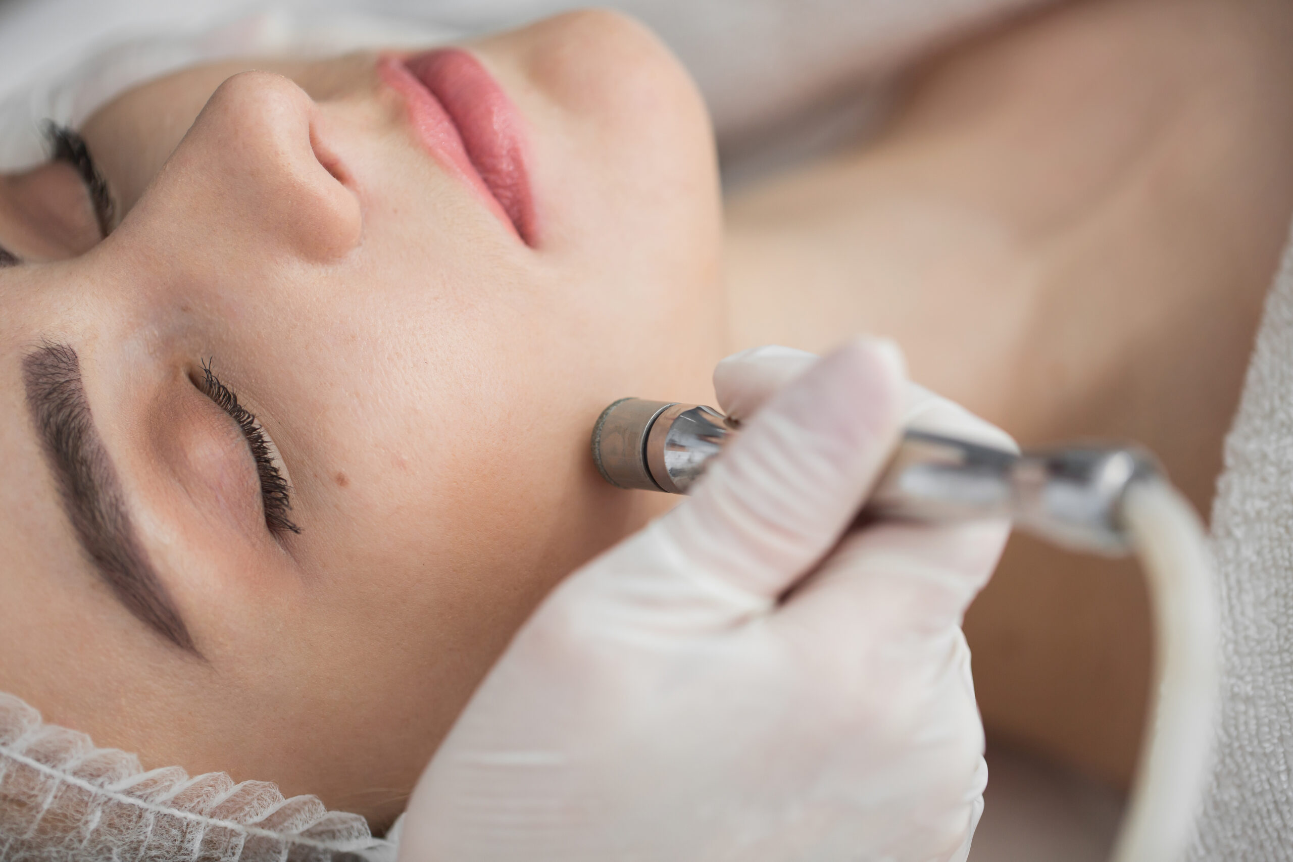 Microdermabrasion Berlin Hautarzt Titelbild