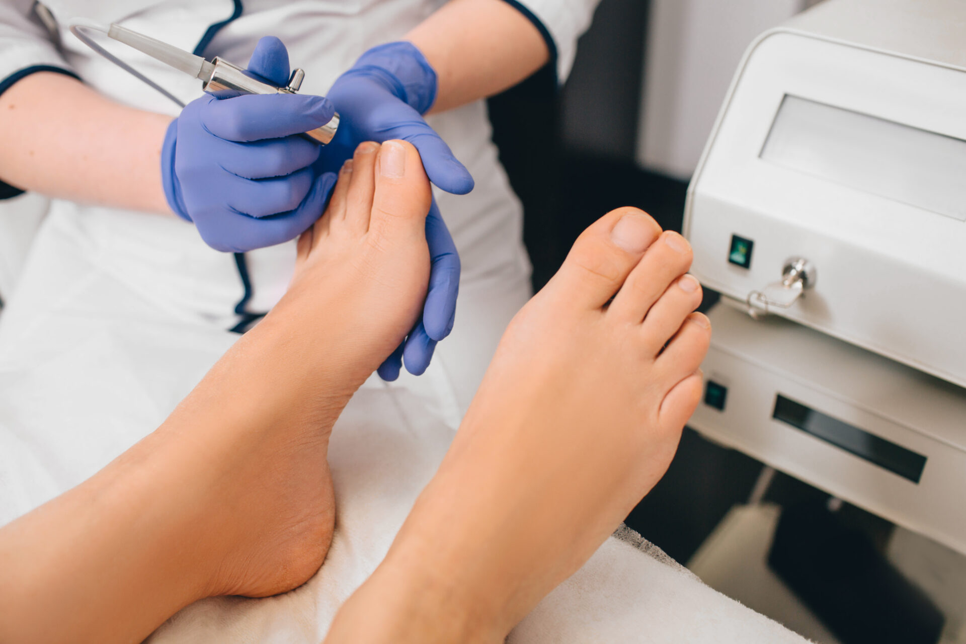 Nagelpilz Behandlung Laser Berlin Lichterfelde