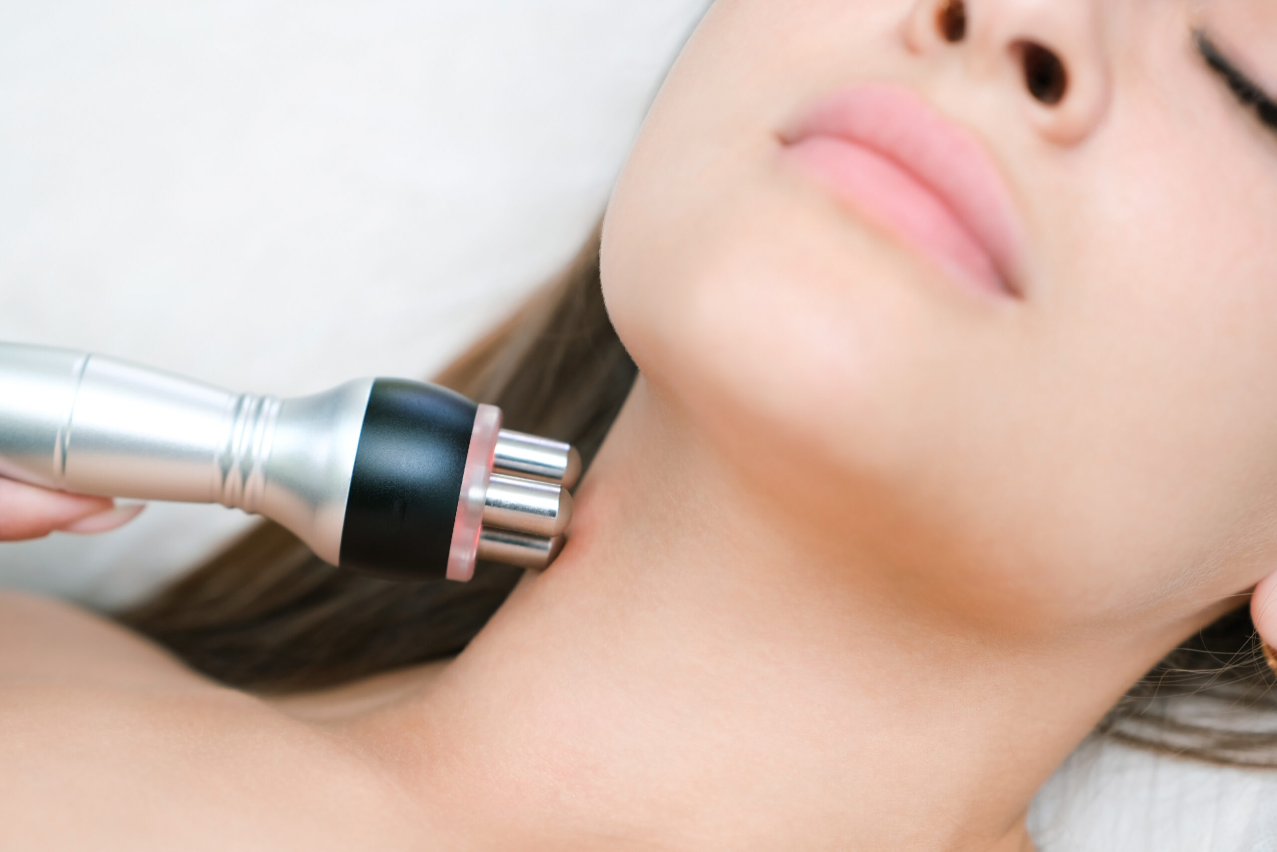 Radiofrequenz Behandlung Berlin